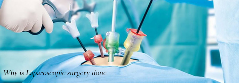 Why is Laparoscopic Surgery Done